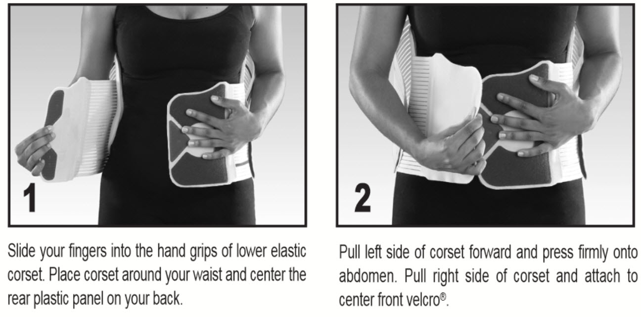 VertaMax Lumbosacral Orthosis LSO Back Brace